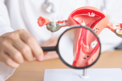 Doctor , magnifying glass in a female reproductive organ