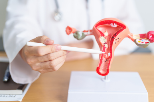 Diagnosing endometriosis