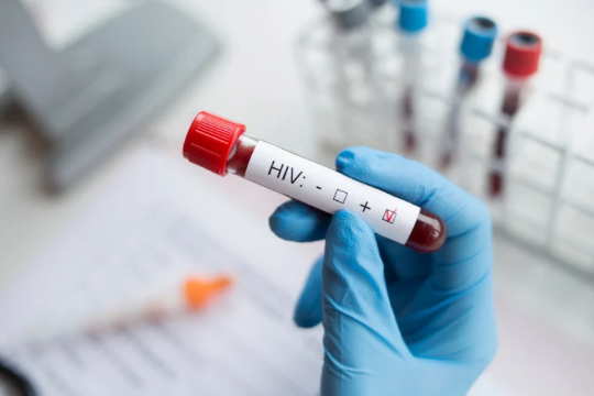 Blood test with “HIV Test” word